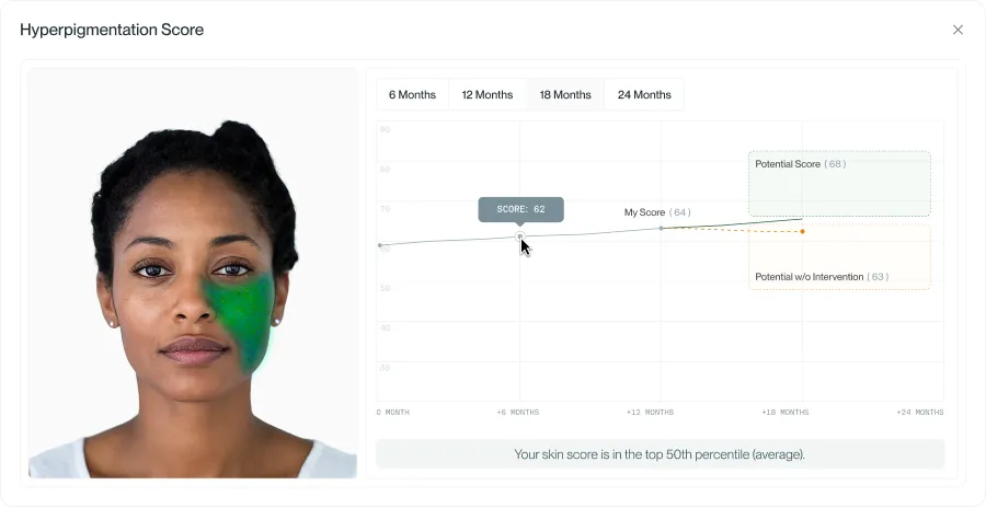 Hyperpigmentation score Hyperpigmentation score