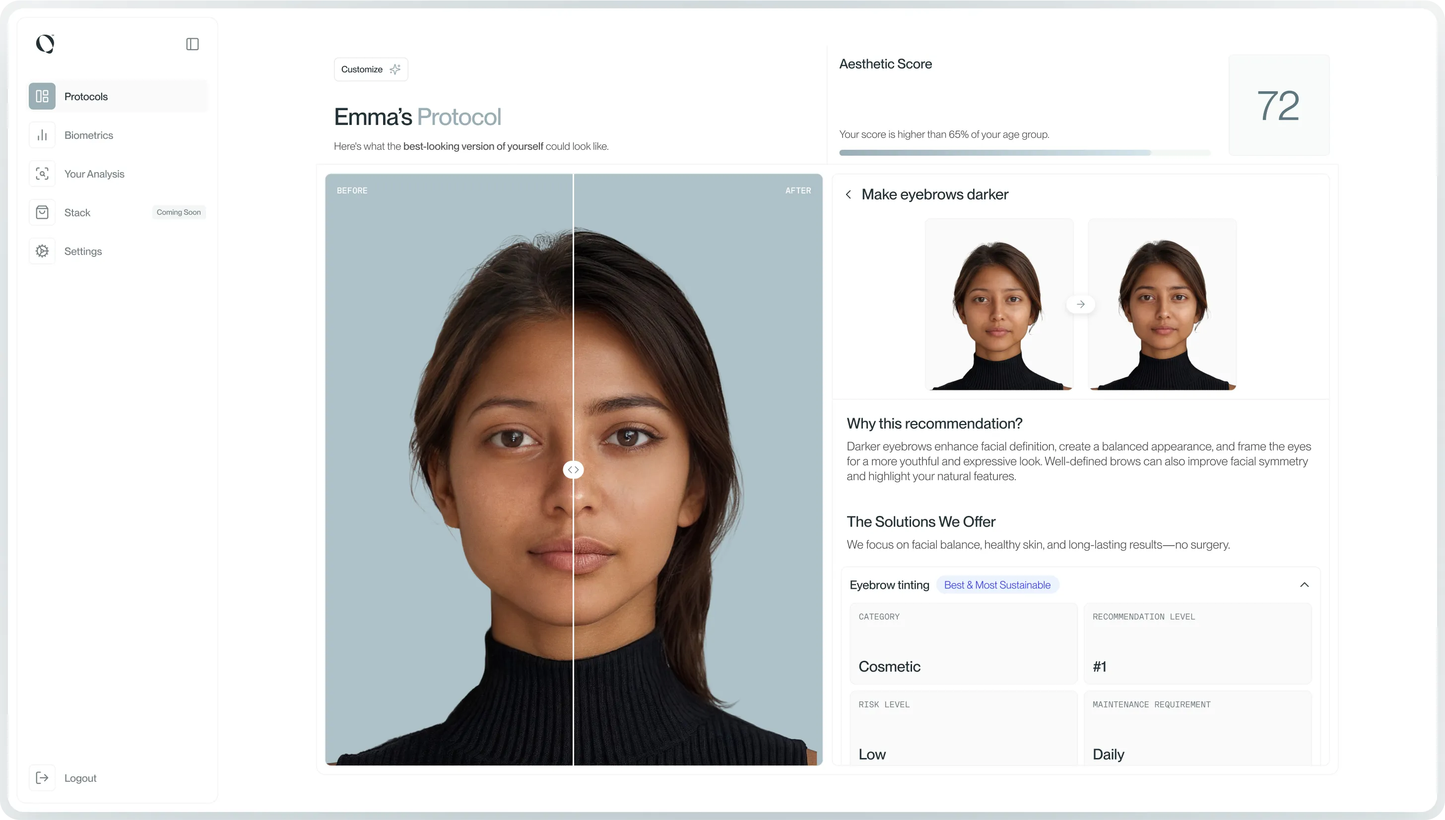 ELYRA portal example ELYRA portal example